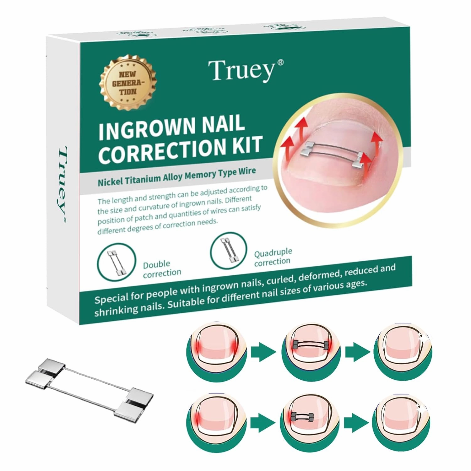 Cuttable Titanium Alloy Silicone Ingrown Toenail Treatment,Designed for Curved Nail Repair, Ingrown Toenail Corrector at Home,Ingrown Toenail Removal Kit, Adjustable for Any nail Sizes,reusable