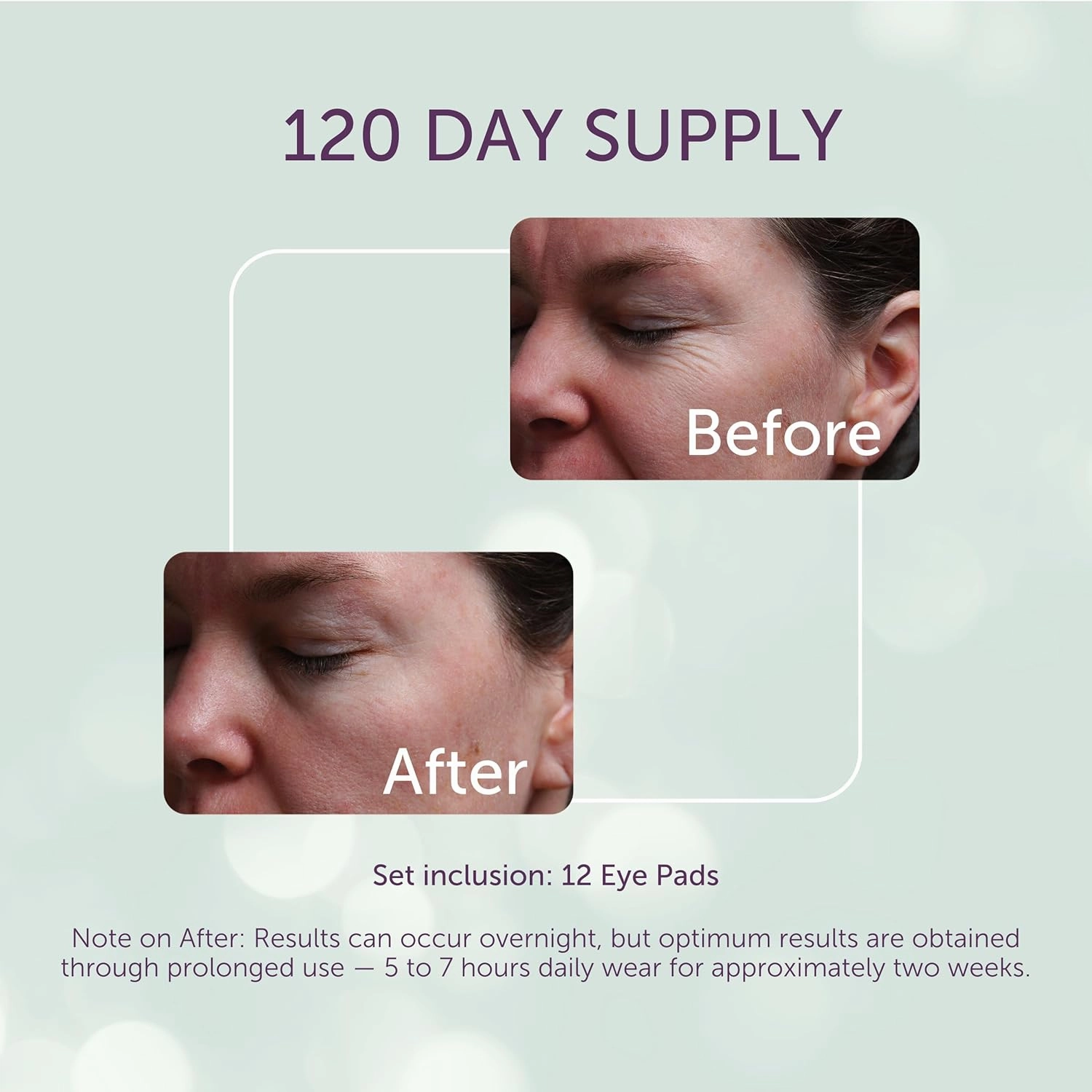 SilcSkin Silicone Eye Pads - Reusable Overnight Eye Patches, Medical-grade Silicone for Fine Lines, Crepey Skin, and Puffiness - 120 Day Supply